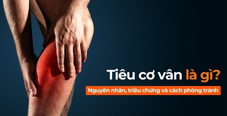Tiêu cơ vân - Hội chứng mất cơ nguy hiểm khi F8 beta2 casino trực tuyến, xổ số, nổ hũ, bắn cá quá sức
