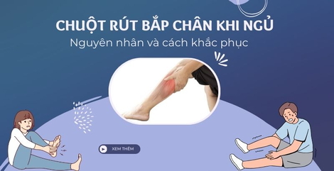 Tại sao lại bị chuột rút bắp chân khi ngủ: Nguyên nhân và cách khắc phục